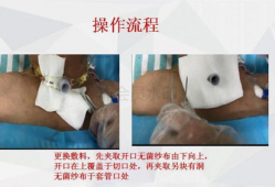 采血针的使用方法视频,轻松掌握采血技巧